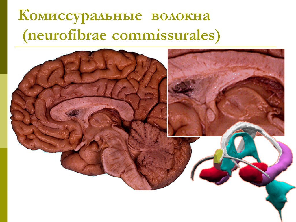 Комиссуральные волокна (neurofibrae commissurales)